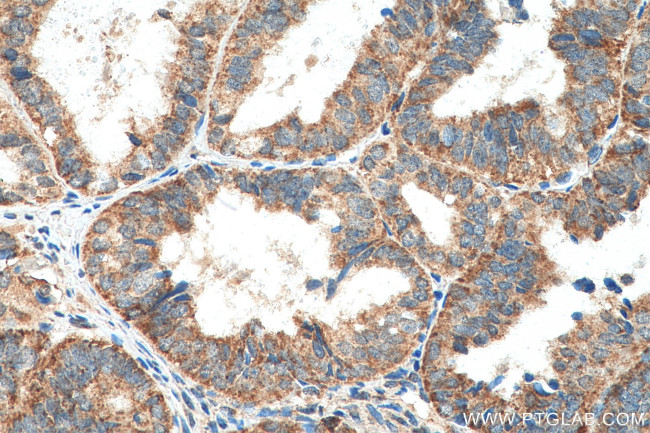 MRPL45 Antibody in Immunohistochemistry (Paraffin) (IHC (P))