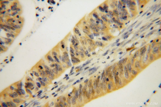 GMPR 1/2 Antibody in Immunohistochemistry (Paraffin) (IHC (P))