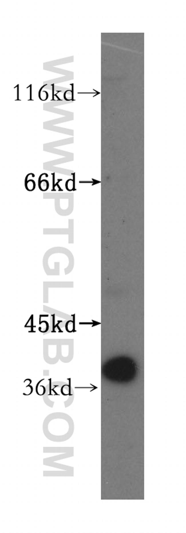 GMPR 1/2 Antibody in Western Blot (WB)