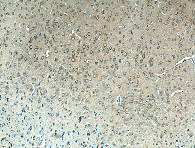 REEP2 Antibody in Immunohistochemistry (Paraffin) (IHC (P))