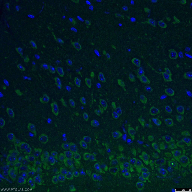 REEP2 Antibody in Immunohistochemistry (PFA fixed) (IHC (PFA))