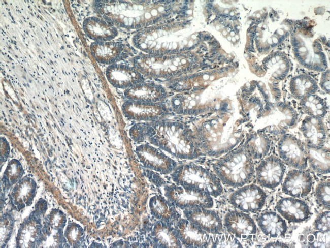 UBE2H Antibody in Immunohistochemistry (Paraffin) (IHC (P))