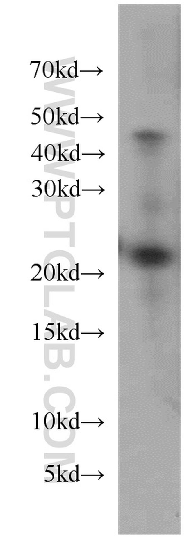 UBE2H Antibody in Western Blot (WB)