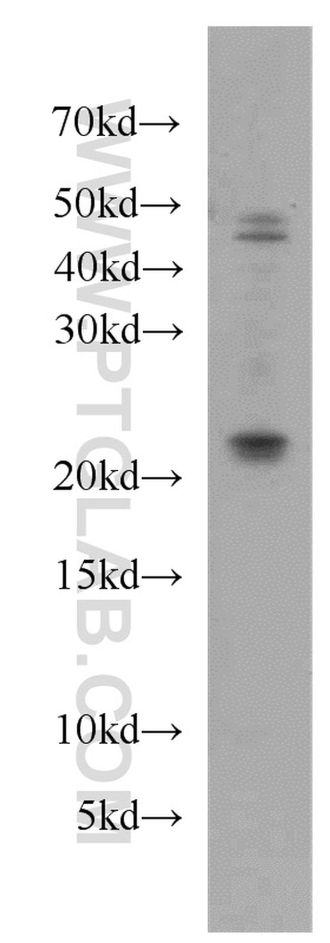 UBE2H Antibody in Western Blot (WB)