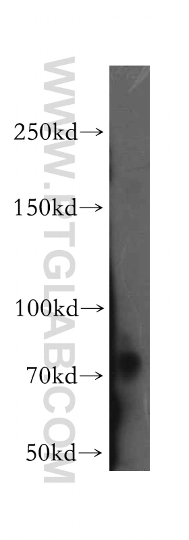 DLG5 Antibody in Western Blot (WB)