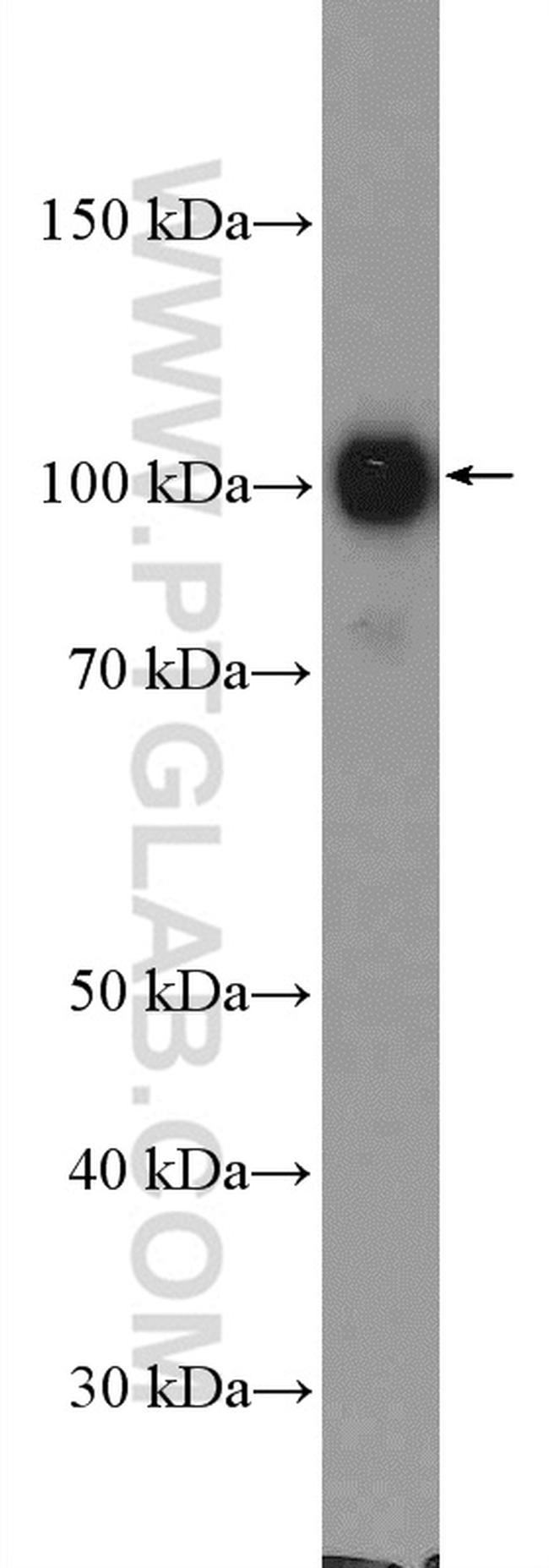 AP2B1 Antibody in Western Blot (WB)