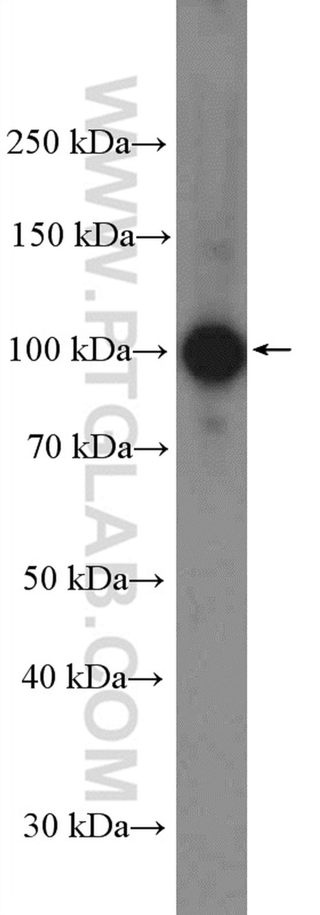 AP2B1 Antibody in Western Blot (WB)