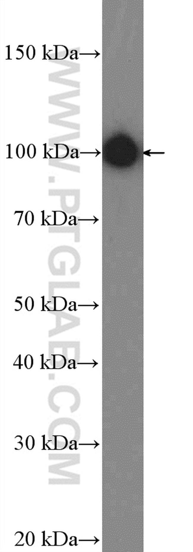 AP2B1 Antibody in Western Blot (WB)