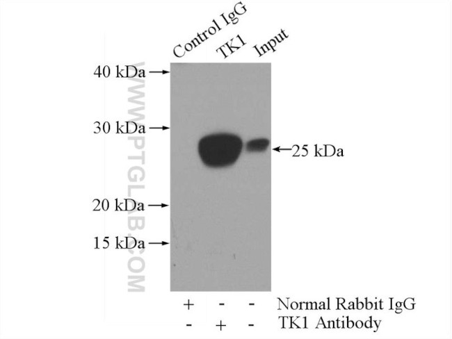 TK1 Antibody in Immunoprecipitation (IP)