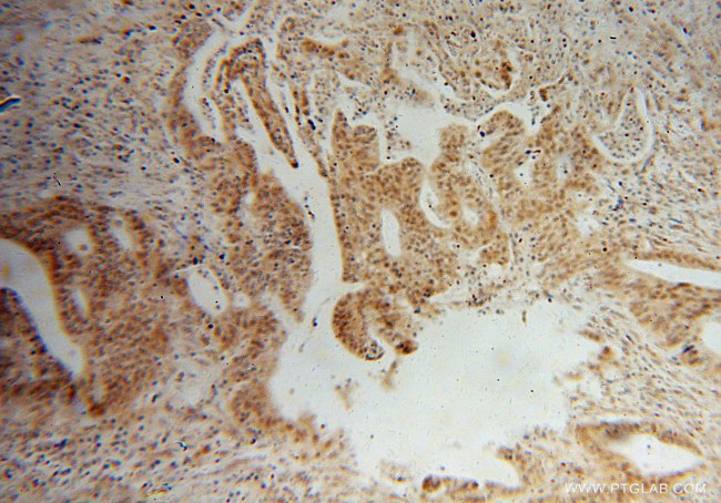 MAP1S Antibody in Immunohistochemistry (Paraffin) (IHC (P))