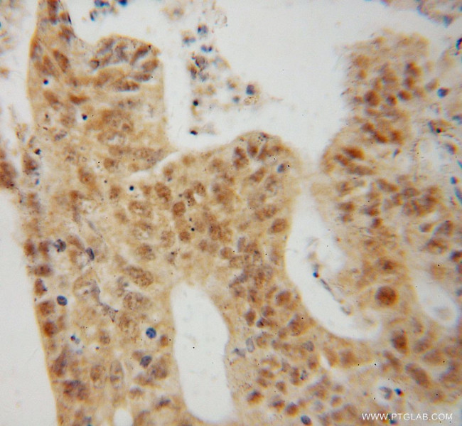 MAP1S Antibody in Immunohistochemistry (Paraffin) (IHC (P))