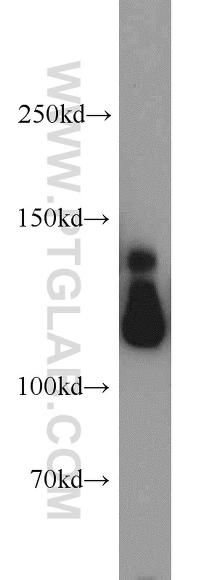 MAP1S Antibody in Western Blot (WB)