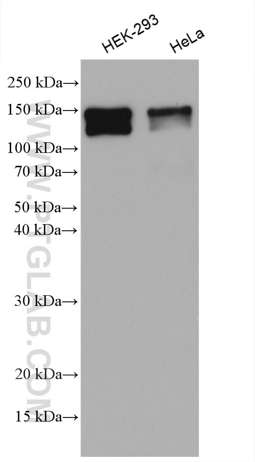 MAP1S Antibody in Western Blot (WB)