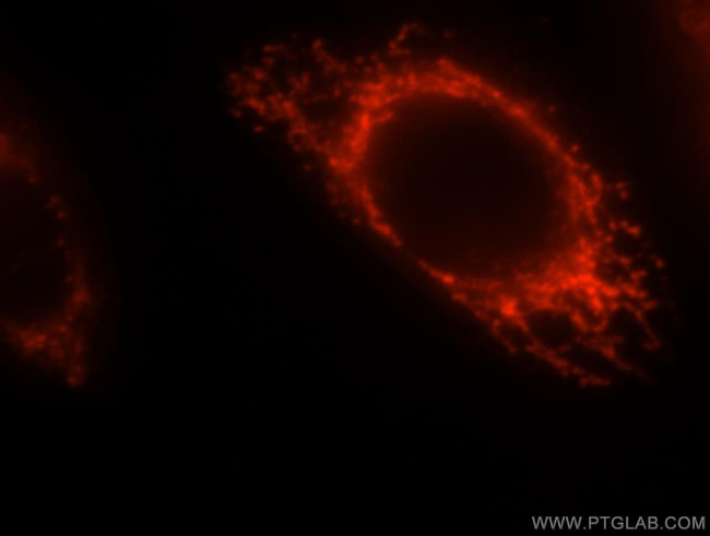 CLPP Antibody in Immunocytochemistry (ICC/IF)