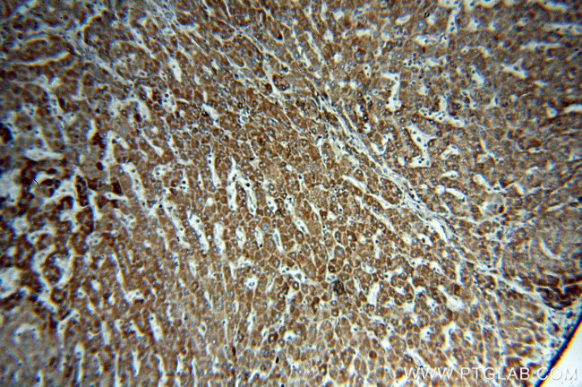 CLPP Antibody in Immunohistochemistry (Paraffin) (IHC (P))