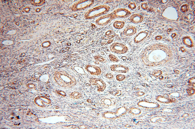 CLPP Antibody in Immunohistochemistry (Paraffin) (IHC (P))