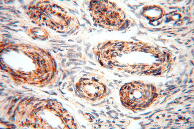 CLPP Antibody in Immunohistochemistry (Paraffin) (IHC (P))