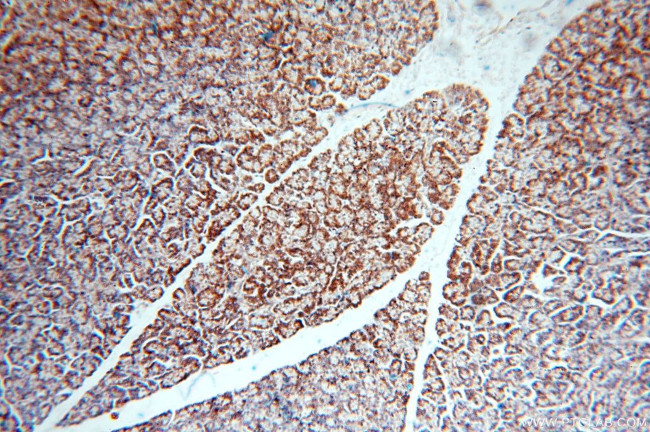 CLPP Antibody in Immunohistochemistry (Paraffin) (IHC (P))