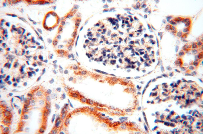 CLPP Antibody in Immunohistochemistry (Paraffin) (IHC (P))