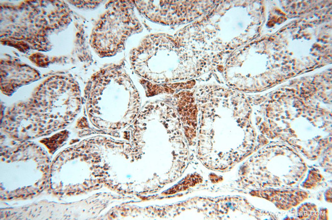 CLPP Antibody in Immunohistochemistry (Paraffin) (IHC (P))