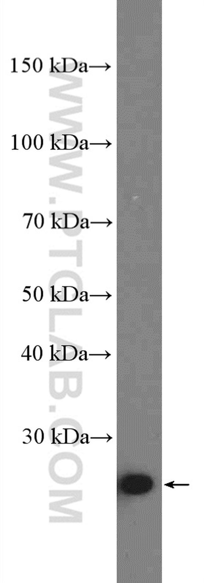 CLPP Antibody in Western Blot (WB)