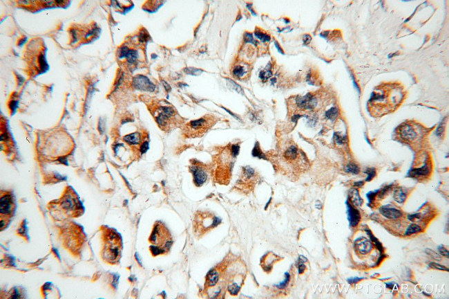 IGFBP2 Antibody in Immunohistochemistry (Paraffin) (IHC (P))