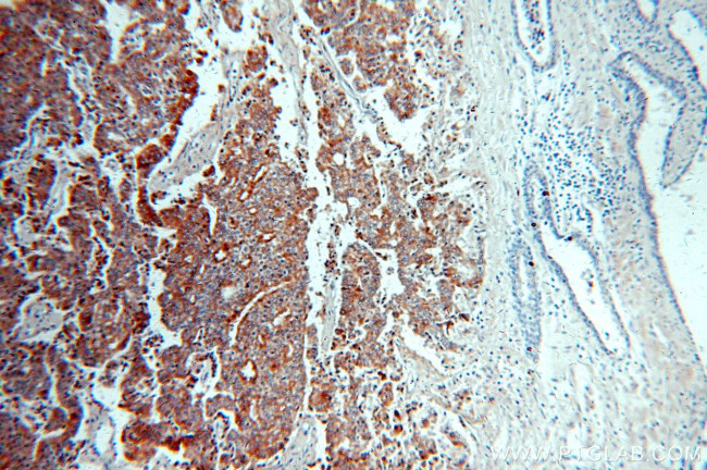 IGFBP2 Antibody in Immunohistochemistry (Paraffin) (IHC (P))