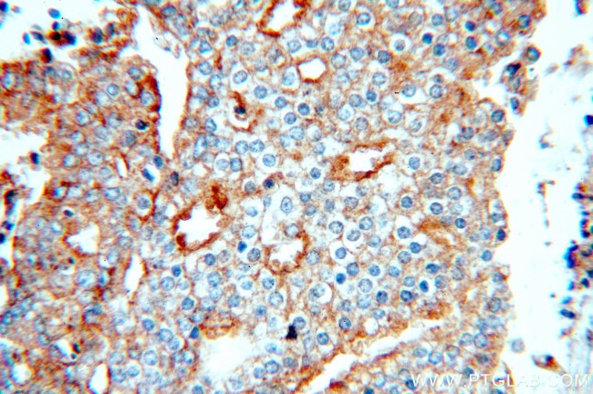 IGFBP2 Antibody in Immunohistochemistry (Paraffin) (IHC (P))