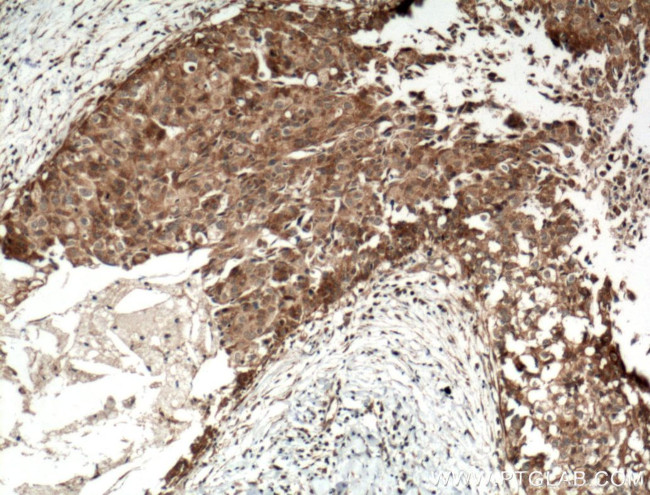 IGFBP2 Antibody in Immunohistochemistry (Paraffin) (IHC (P))