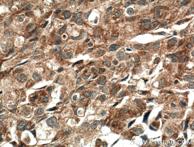 IGFBP2 Antibody in Immunohistochemistry (Paraffin) (IHC (P))