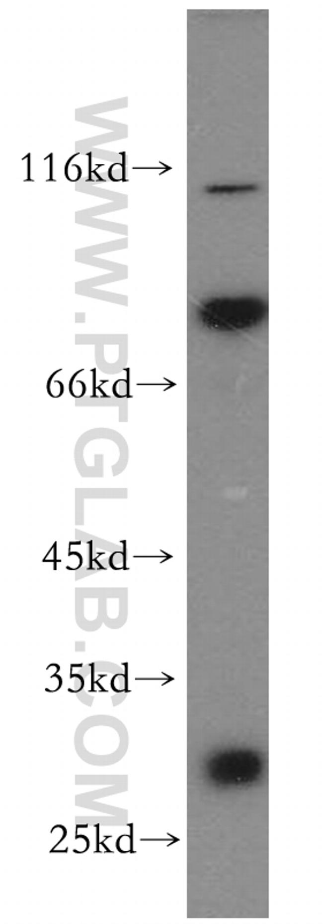 IGFBP2 Antibody in Western Blot (WB)