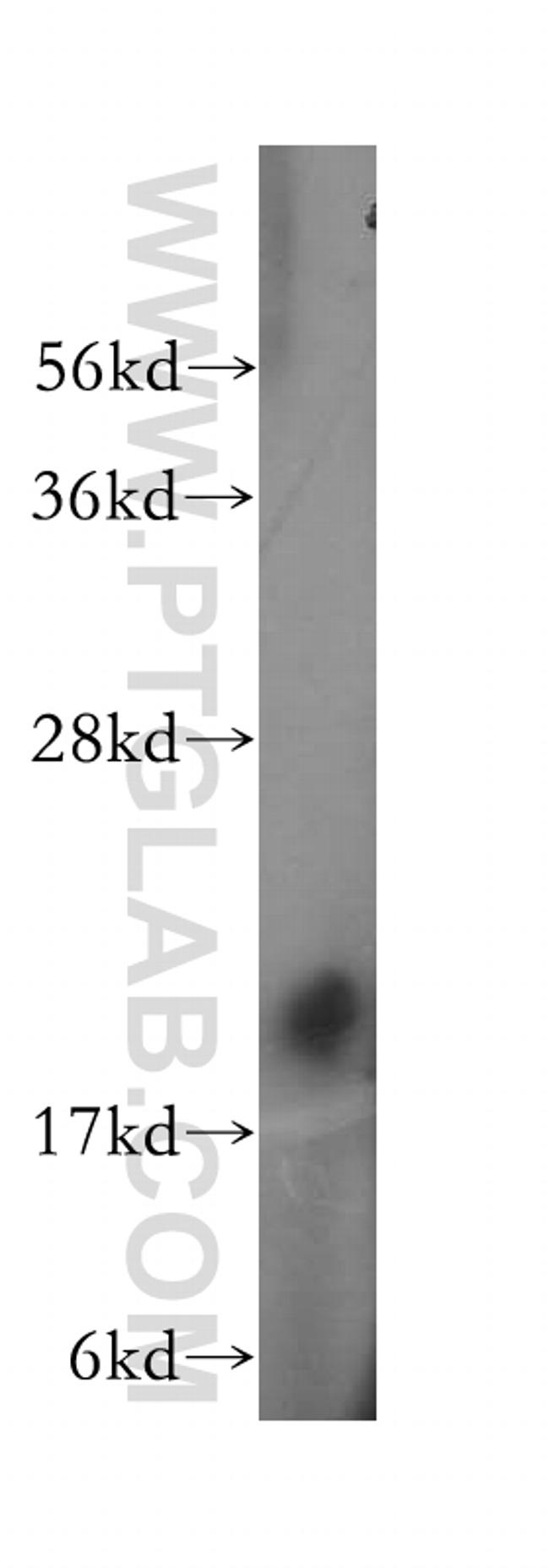 HSPB7 Antibody in Western Blot (WB)