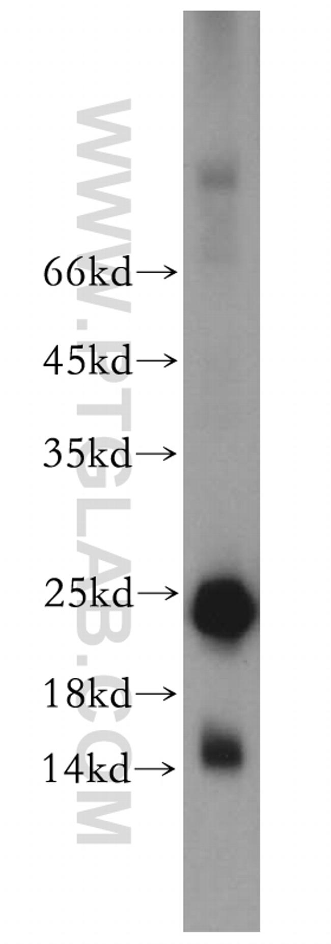 HSPB7 Antibody in Western Blot (WB)