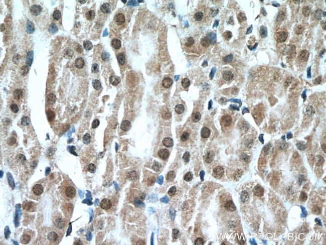 PCBD1 Antibody in Immunohistochemistry (Paraffin) (IHC (P))