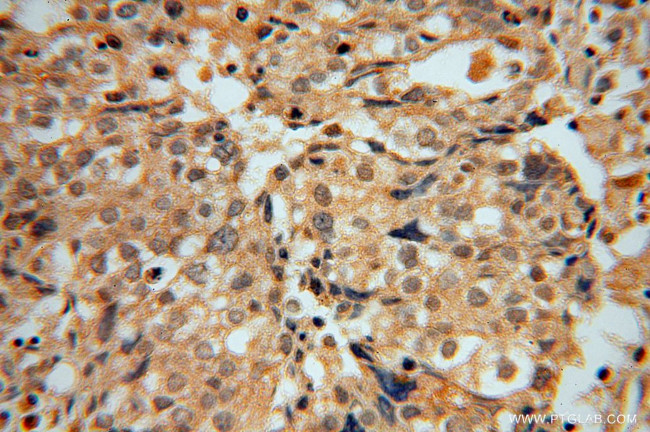 PCBD1 Antibody in Immunohistochemistry (Paraffin) (IHC (P))