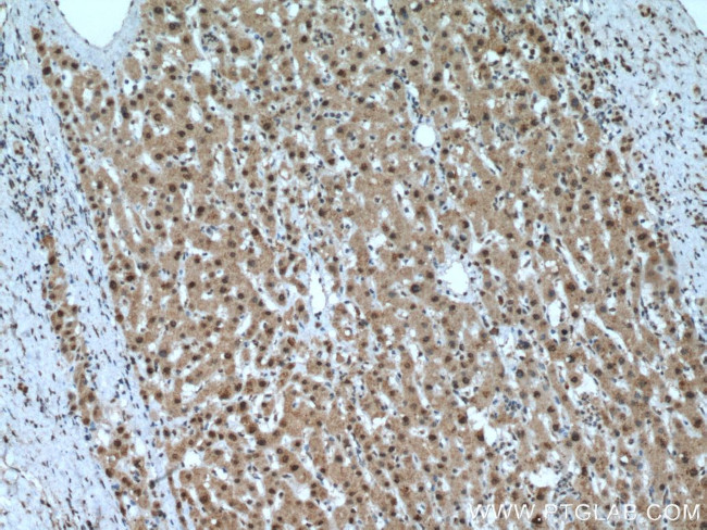 PCBD1 Antibody in Immunohistochemistry (Paraffin) (IHC (P))