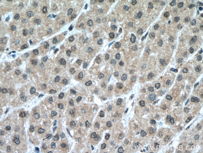 PCBD1 Antibody in Immunohistochemistry (Paraffin) (IHC (P))