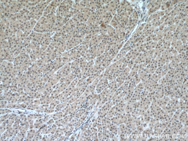 PCBD1 Antibody in Immunohistochemistry (Paraffin) (IHC (P))