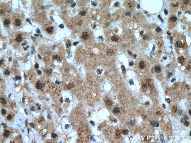 PCBD1 Antibody in Immunohistochemistry (Paraffin) (IHC (P))