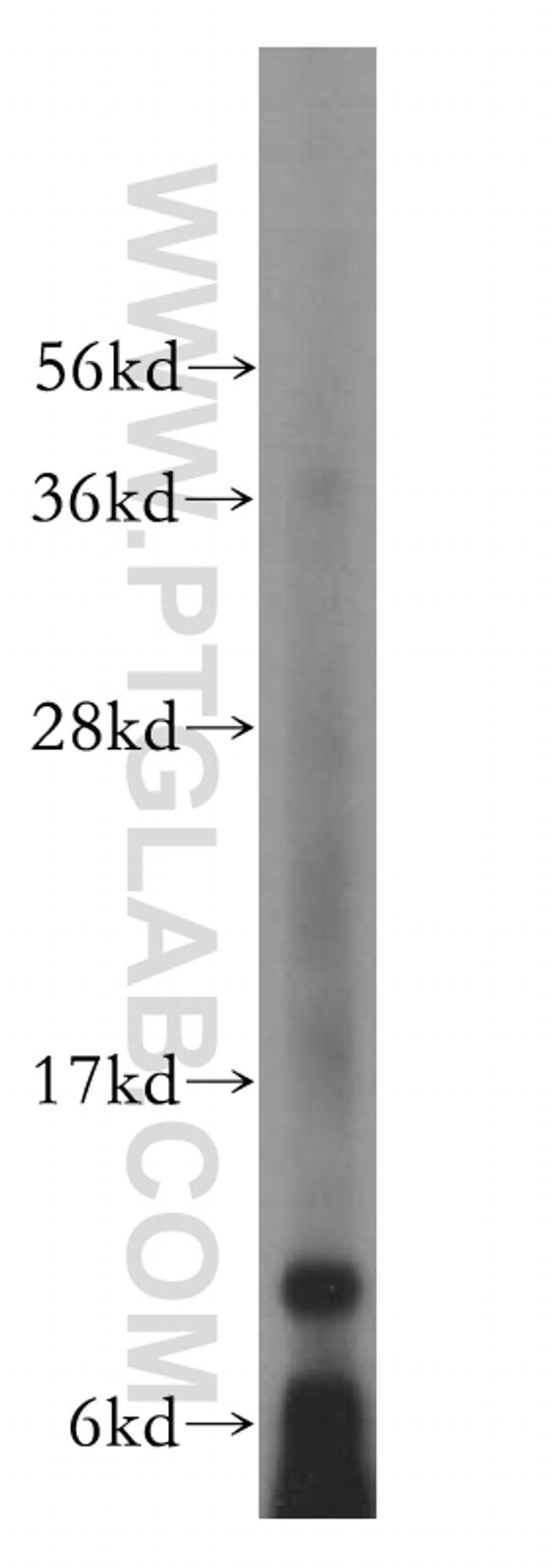 PCBD1 Antibody in Western Blot (WB)