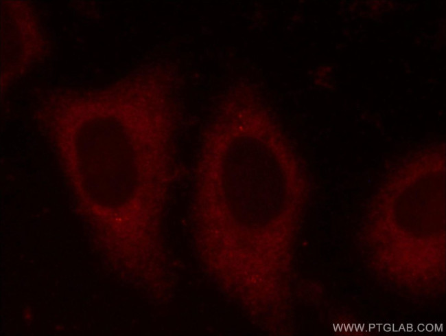 EIF4G1 Antibody in Immunocytochemistry (ICC/IF)