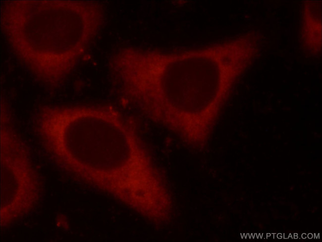 EIF4G1 Antibody in Immunocytochemistry (ICC/IF)