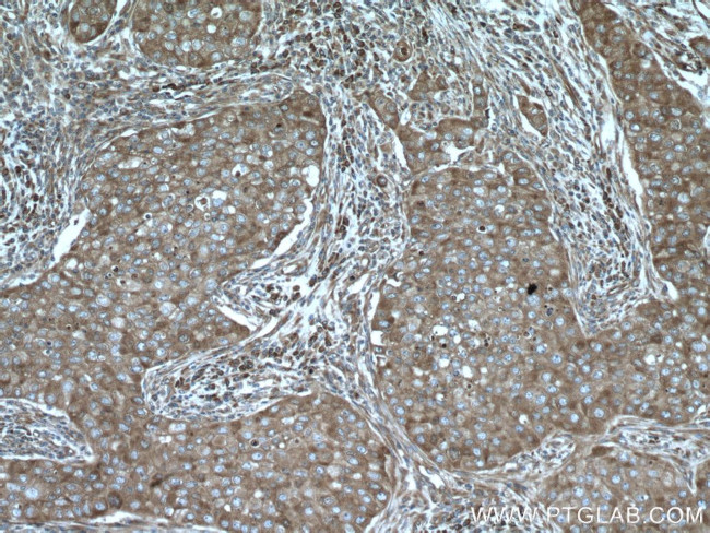 EIF4G1 Antibody in Immunohistochemistry (Paraffin) (IHC (P))