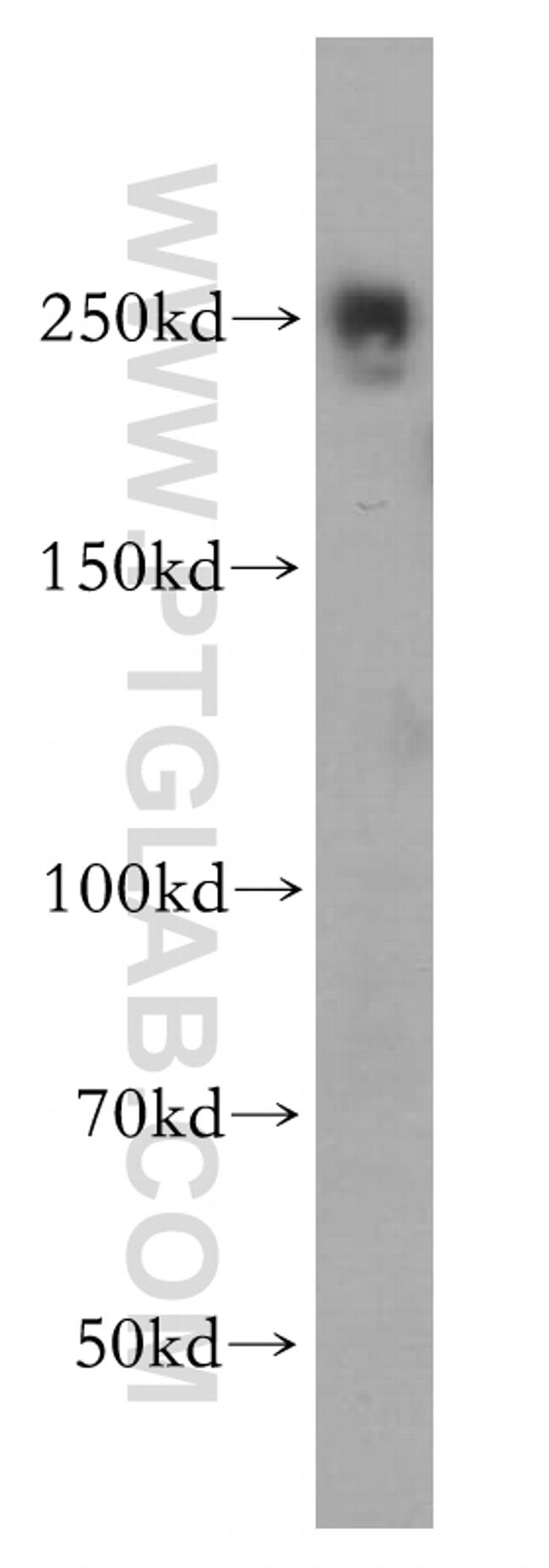 EIF4G1 Antibody in Western Blot (WB)