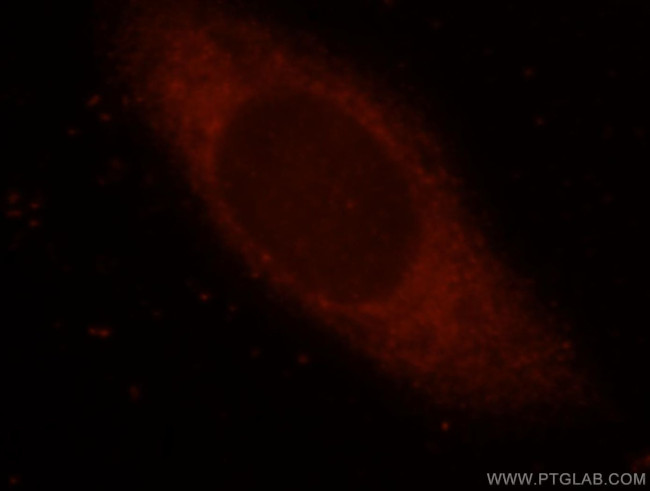 EIF4G1 Antibody in Immunocytochemistry (ICC/IF)