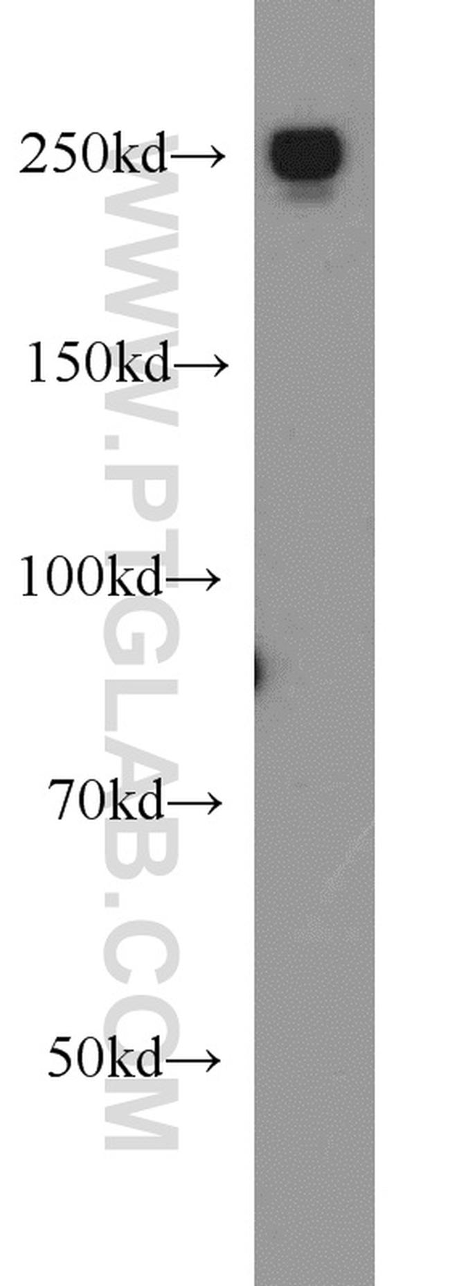 EIF4G1 Antibody in Western Blot (WB)