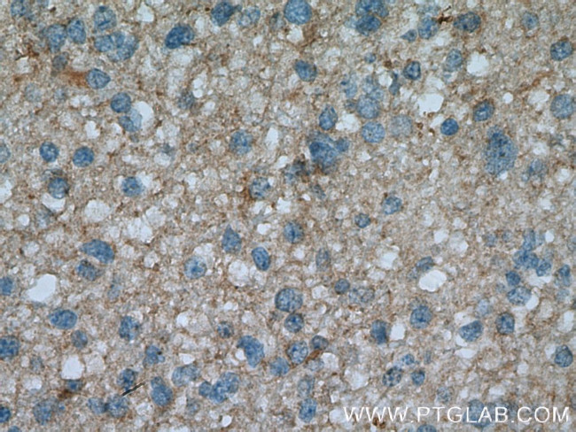 L2HGDH Antibody in Immunohistochemistry (Paraffin) (IHC (P))