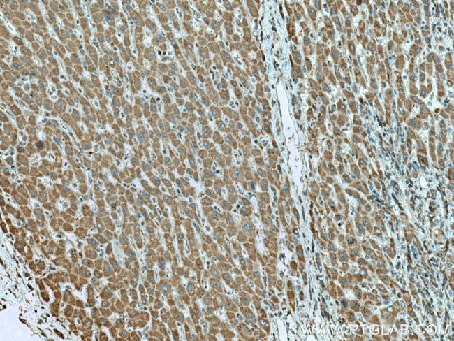 L2HGDH Antibody in Immunohistochemistry (Paraffin) (IHC (P))