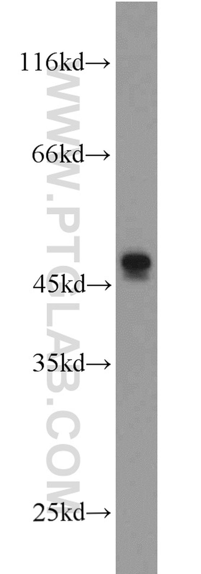 L2HGDH Antibody in Western Blot (WB)