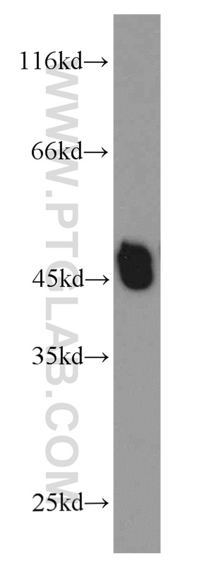 L2HGDH Antibody in Western Blot (WB)